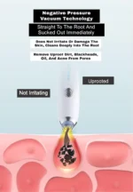 4 In 1 Multi-Function Blackhead Whitehead Remover Extractor Device,Skin Cleaner,Pimple Removal Tool,Pimple Pore Cleaner Vacuum Suction Tool For Men And Women - Image 3